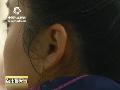 湖南寒意浓浓易生冻疮人群需加强防范